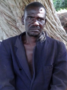 218 A accused wizard in Yendi who had a nail hammered into his head