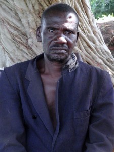 A accused wizard in Yendi who had a nail hammered into his head 